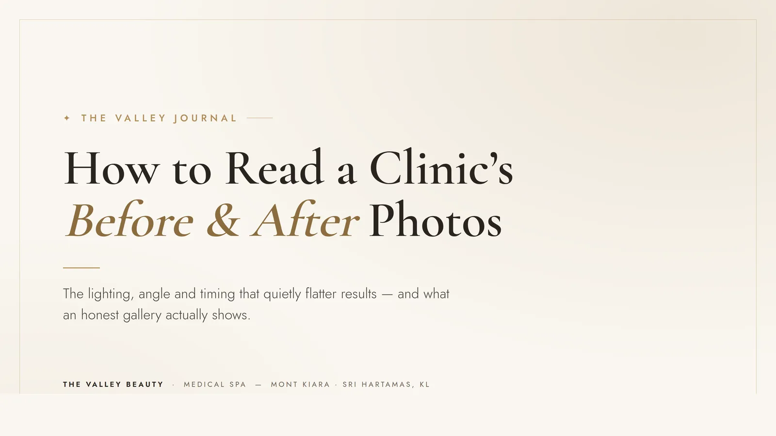 How to read a cosmetic clinic's before-and-after photos (and spot what flatters the result)