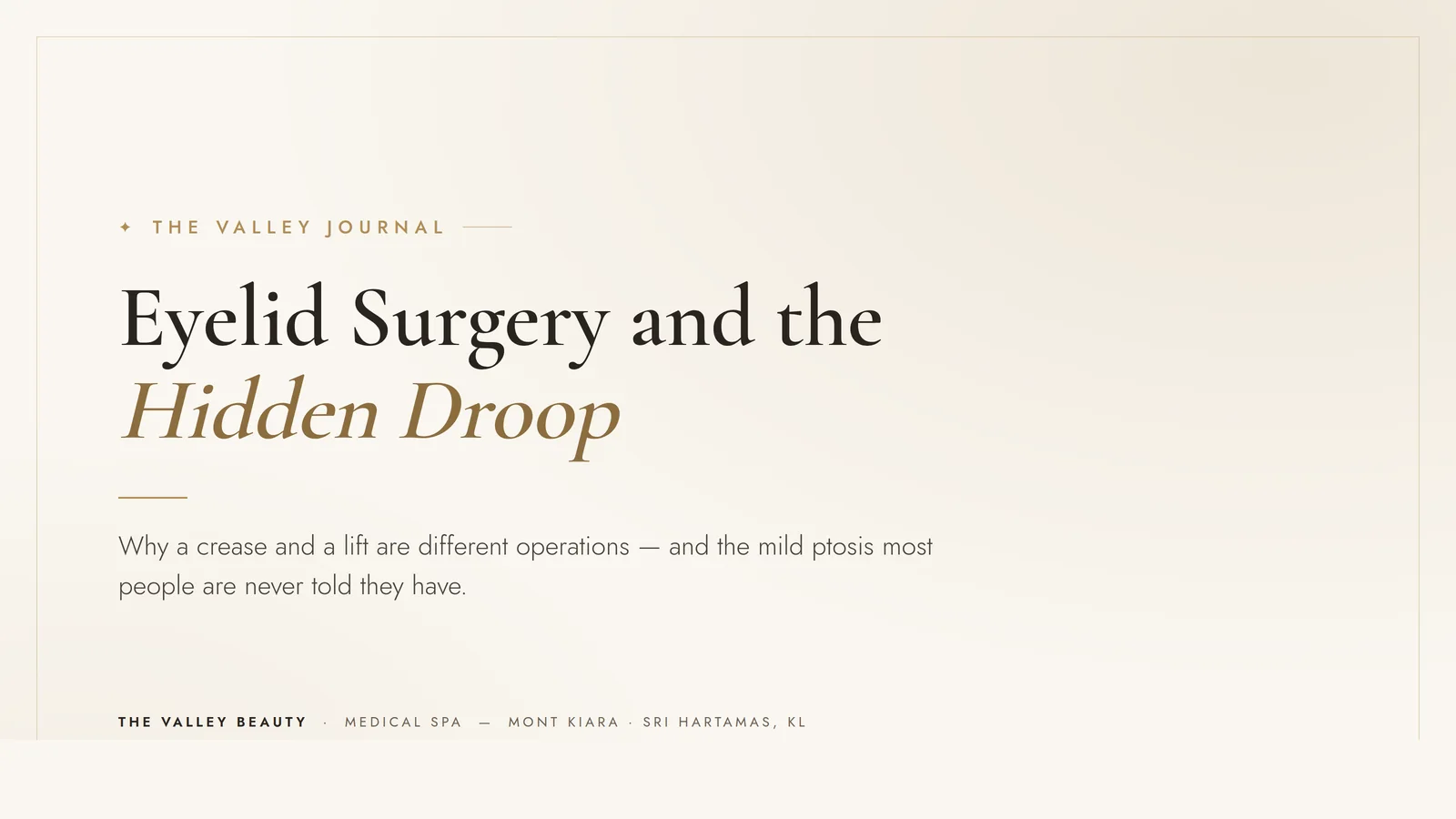Double eyelid surgery is not one operation — and the hidden droop that decides your result