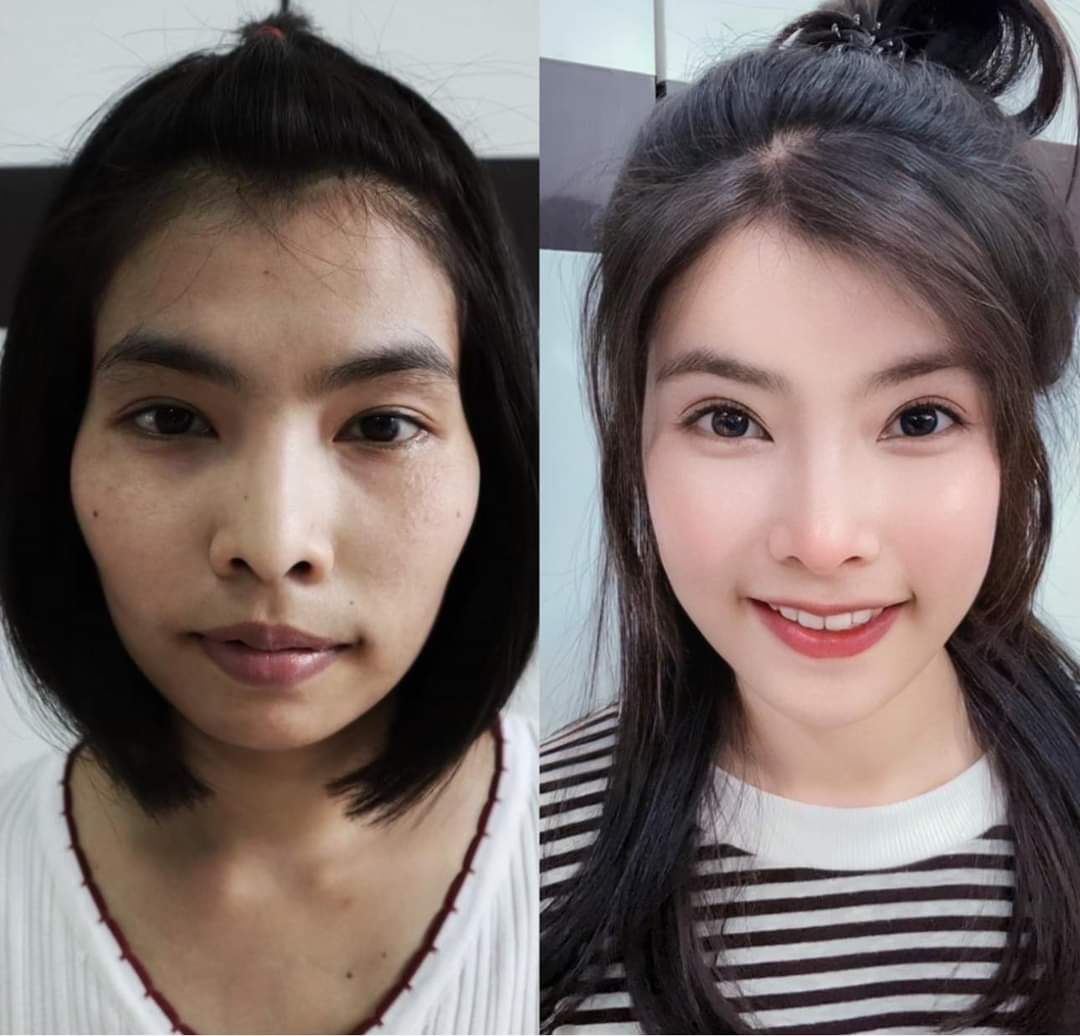 Facelift — Before & After · The Valley, Kuala Lumpur